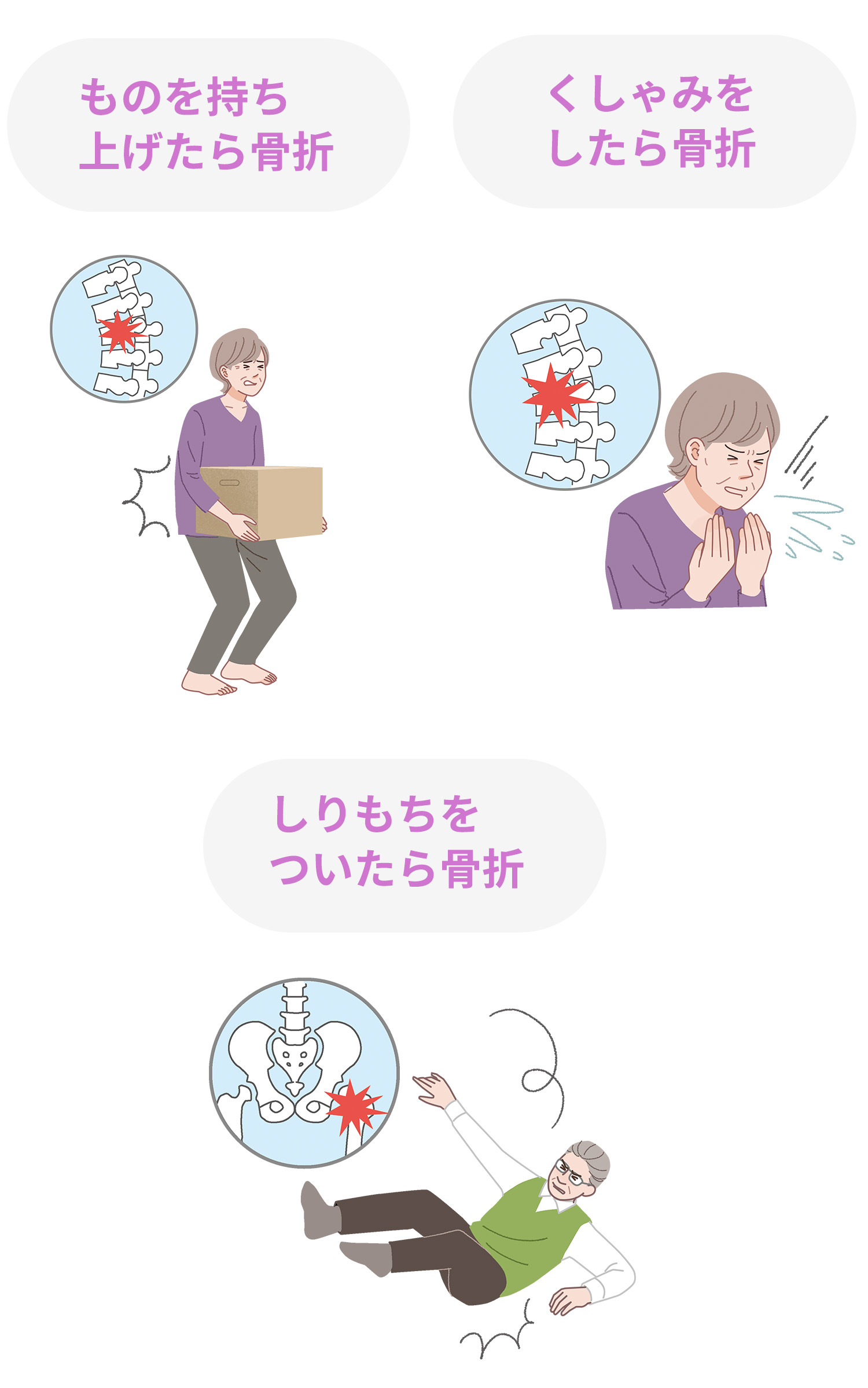 ものを持ち上げたら骨折 くしゃみをしたら骨折 しりもちをついたら骨折