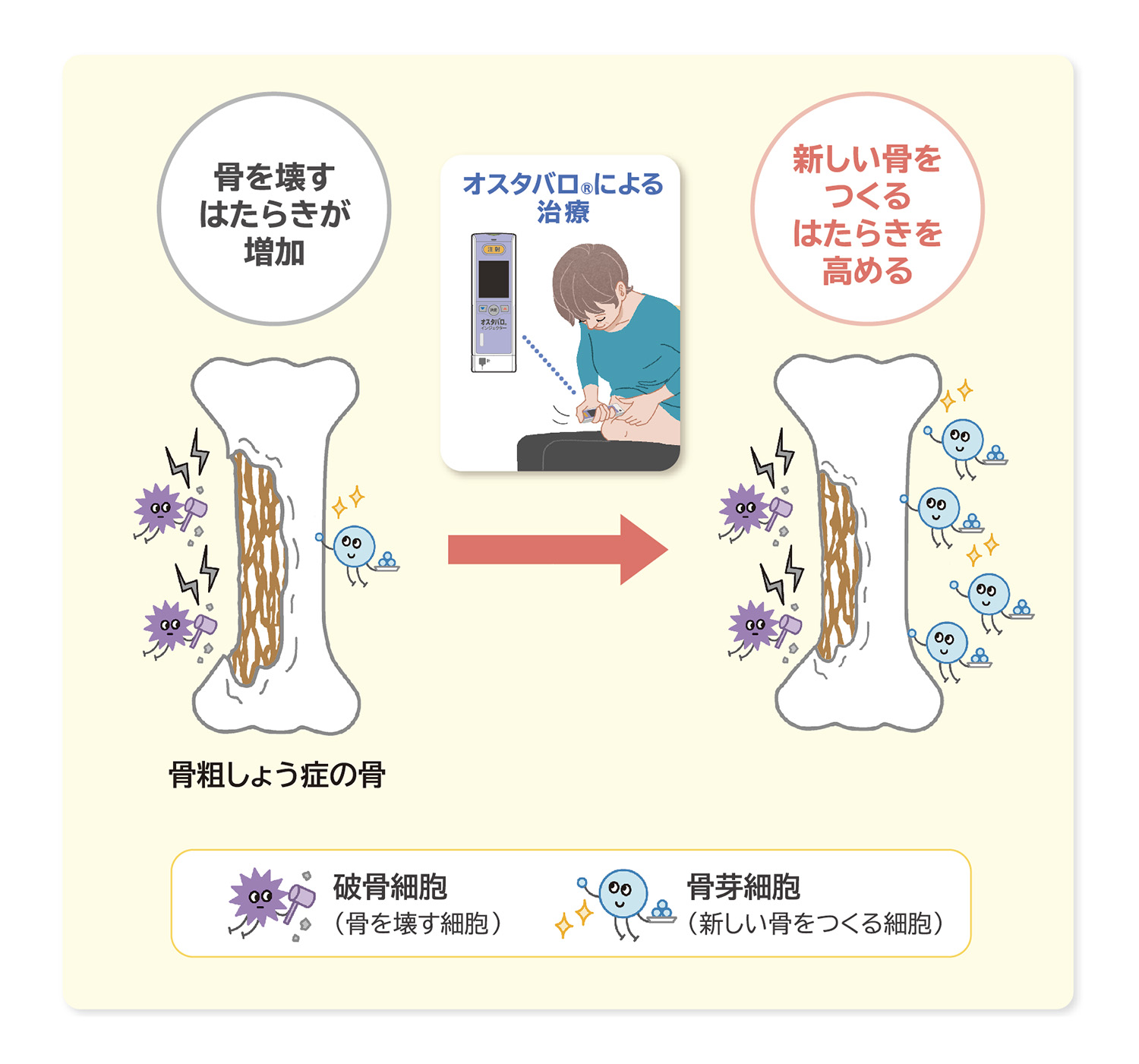 オスタバロの骨に対するはたらきを表したイメージ図