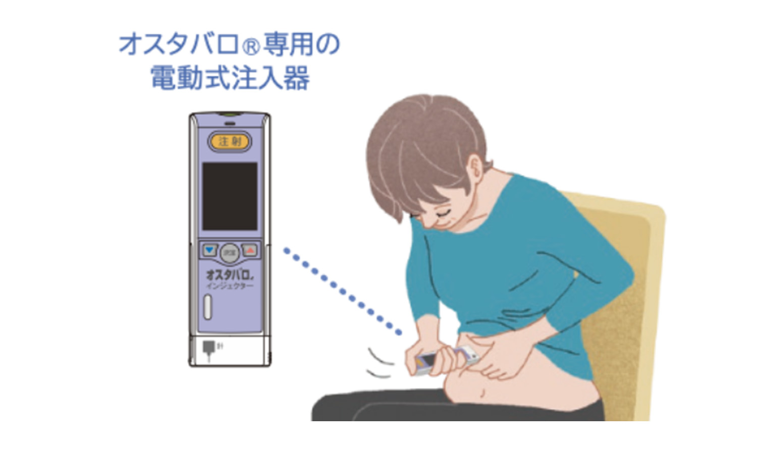 オスタバロ専用の電動式注入器を腹部に注射するイラスト