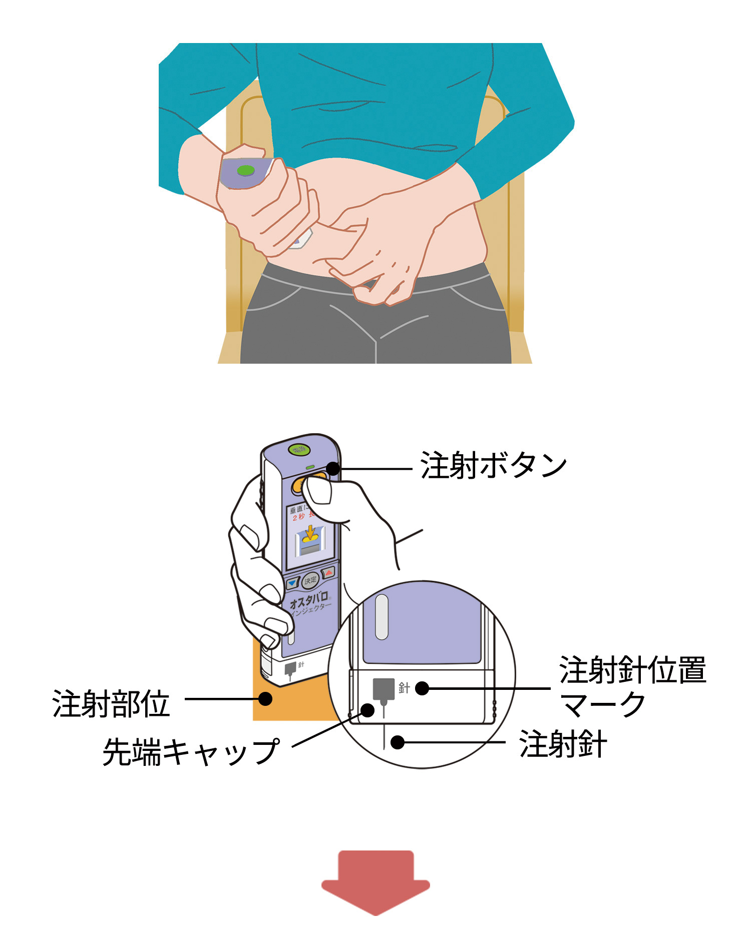 オスタバロインジェクターの先端キャップを垂直に押し当てるイラスト