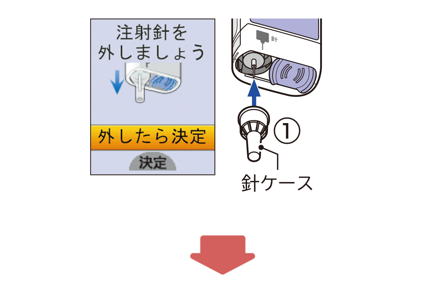 針ケースをまっすぐ取り付けるイラスト